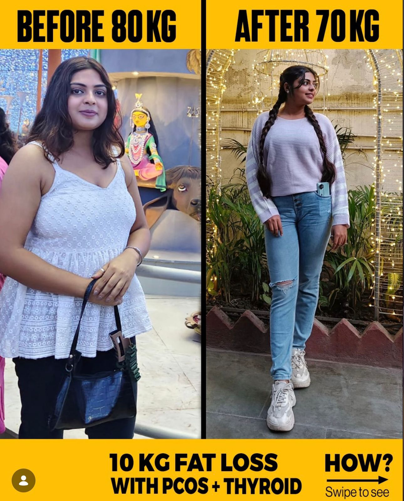 PCOS transformations